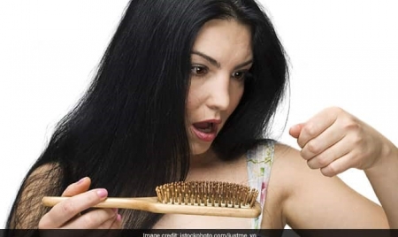 DELHI: Post Covid-19 Hair Fall: Nutritionist Recommends 5 Simple Steps For Healthy Hair Growth