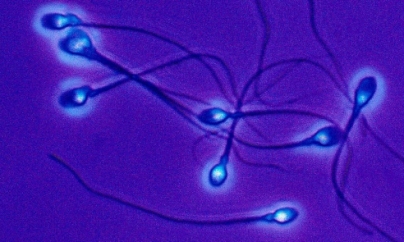 BEIJING: 50 years ago, freezing sperm faced scientific skepticism