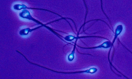 BEIJING: 50 years ago, freezing sperm faced scientific skepticism