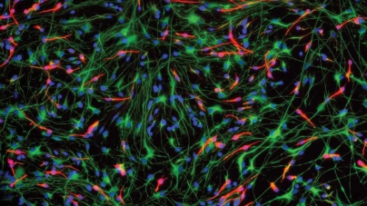 BERLIN : Your Brain Operates at the Edge of Chaos. Why That’s Actually a Good Thing