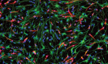 BERLIN : Your Brain Operates at the Edge of Chaos. Why That’s Actually a Good Thing